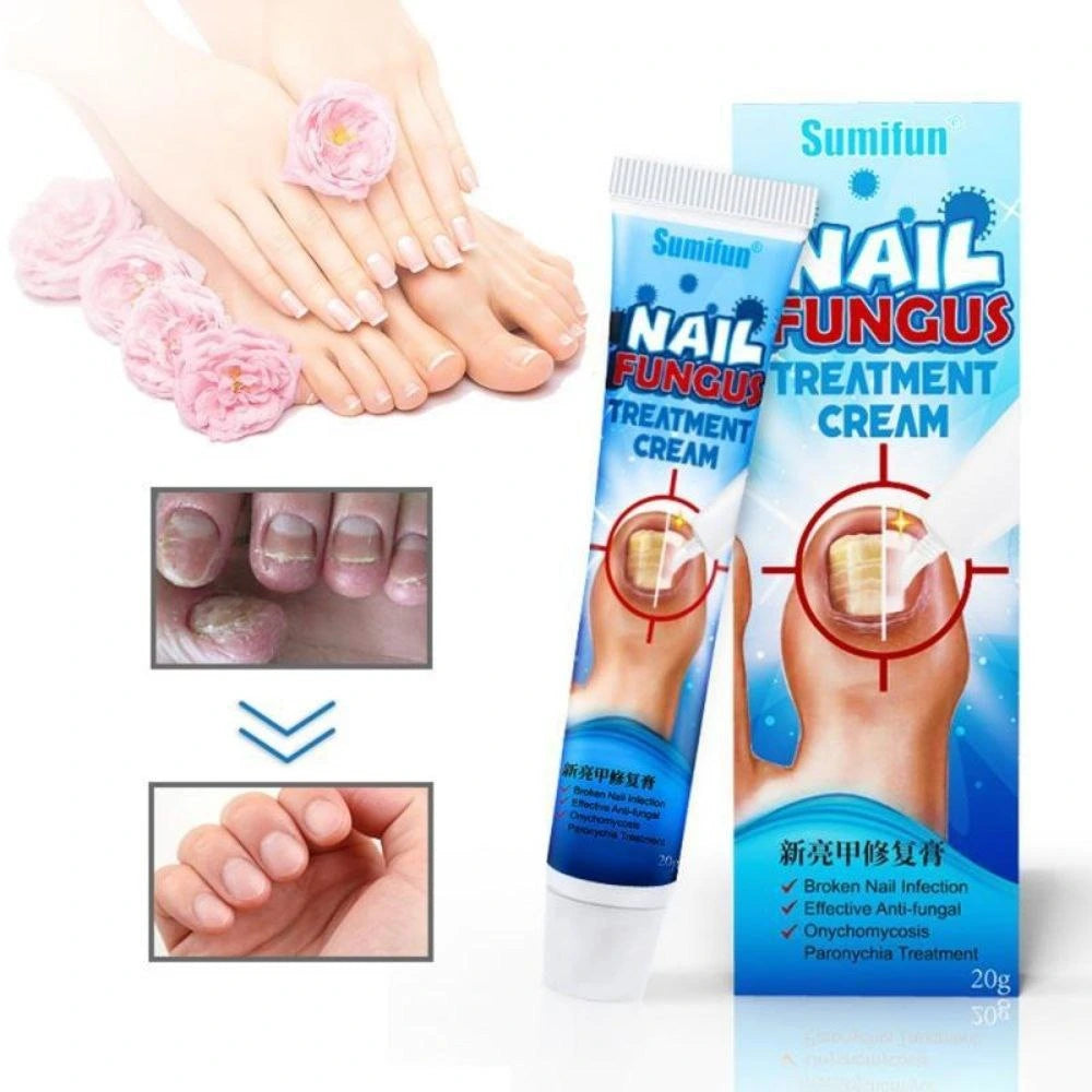 Pommade d'Ongle Sumifun لعلاج فطريات الأظافر والتهابات القدم
